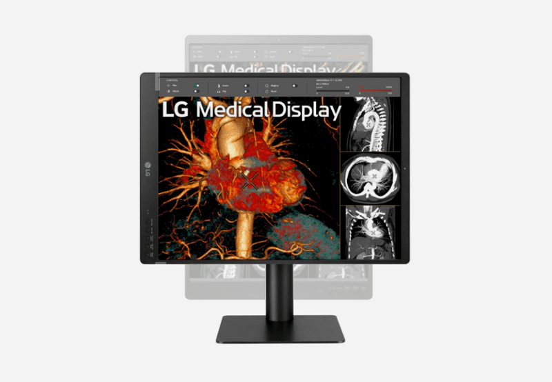 item-Monitor de diagnÃ³stico LG IPS 21,3